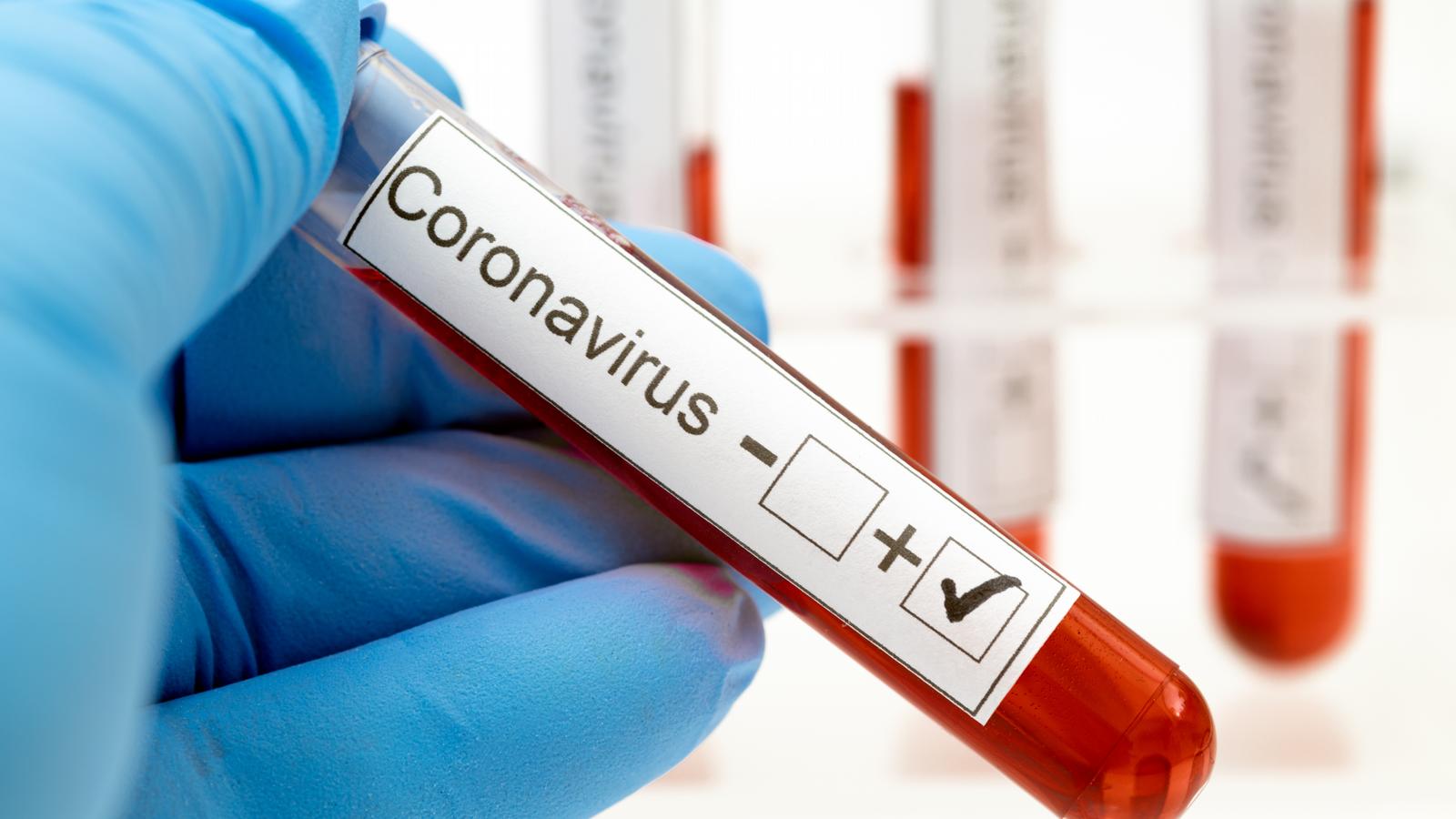 Coronavirus 3_1654957318